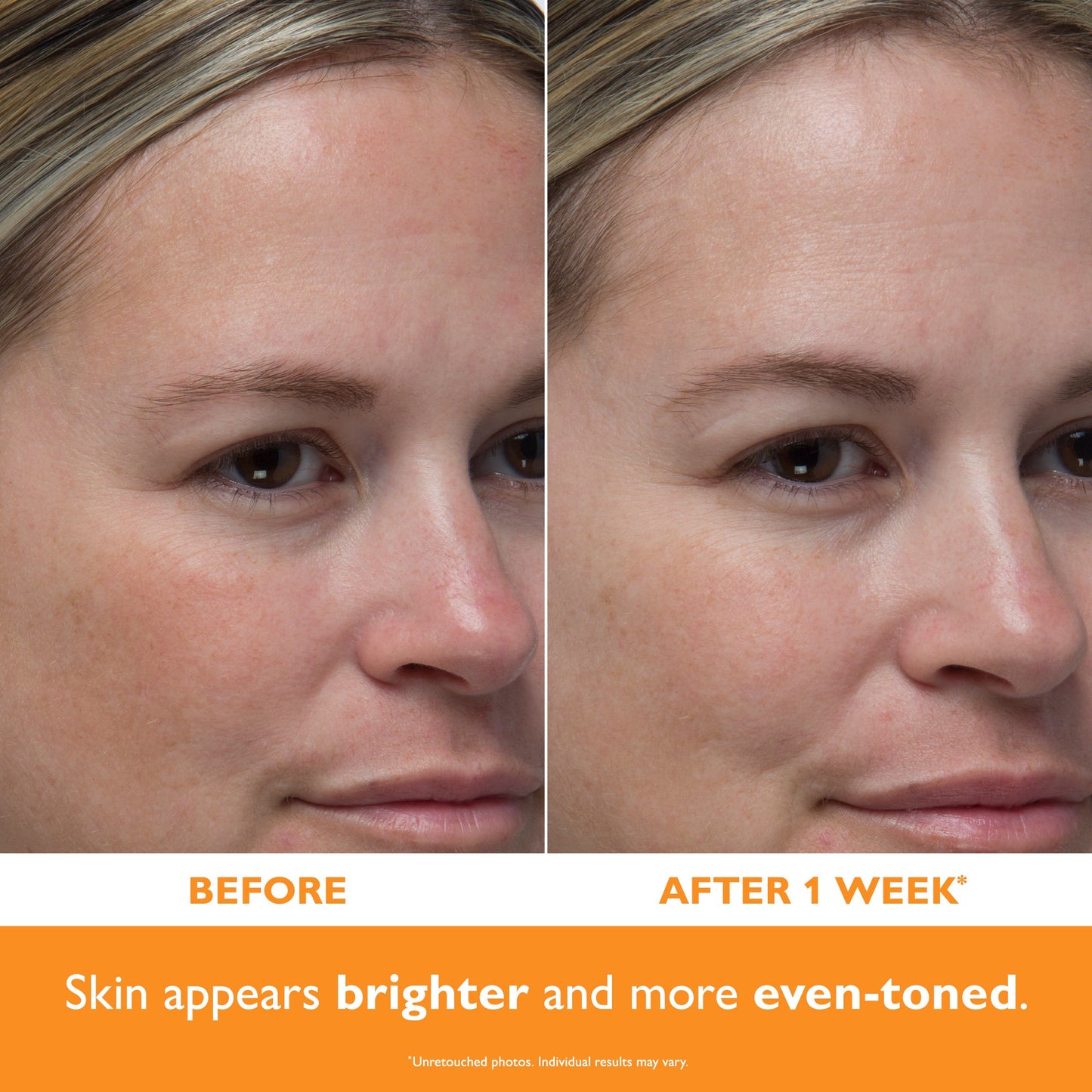 Potent-C Power Serum|30 ml / 1.0 fl oz